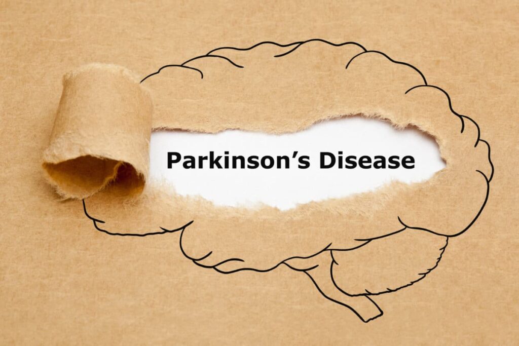 A Guide to Parkinson's Disease Clinical Trials - Tandem Clinical Research